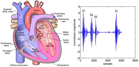 Third heart sound & third heart sound causes