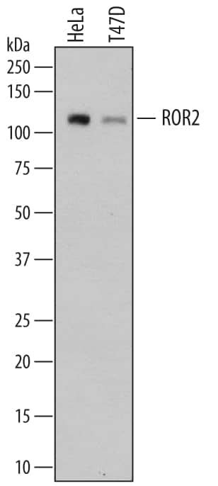 ROR2 Antibody [Unconjugated] (AF2064): Novus Biologicals