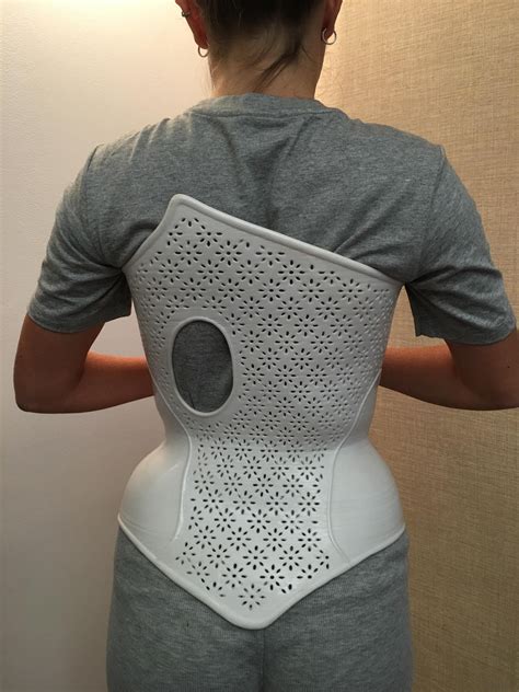 Scoliosis Brace, Scoliosis Exercises, Bad Posture, Poor Posture ...