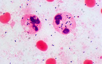 Streptococcus intermedius