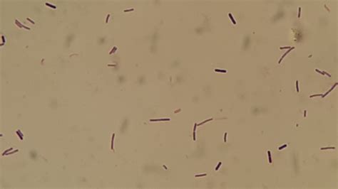 Lactobacillus-Introduction, Morphology, Pathogenicity, Lab Diagnosis