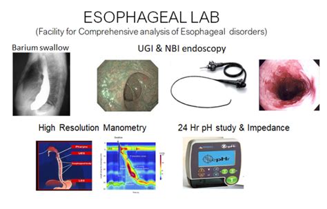 Esophageal Lab - Medindia Hospitals