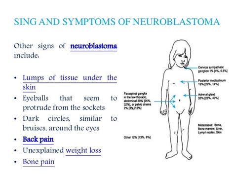 Neuroblastoma: Patient info on symptoms, diagnosis and treatment opti…