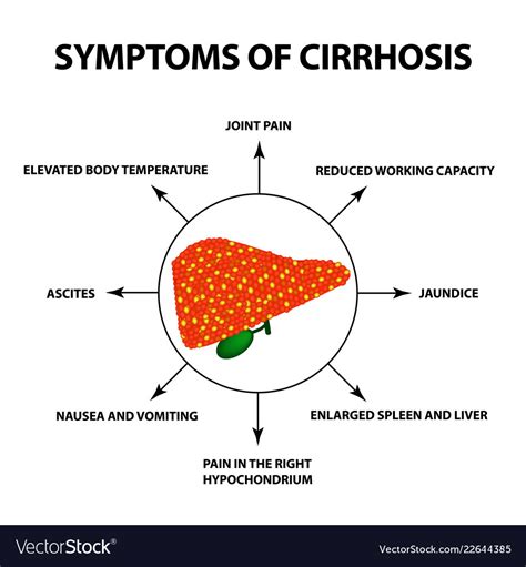 Early symptoms of cirrhosis of the liver information | Variuos