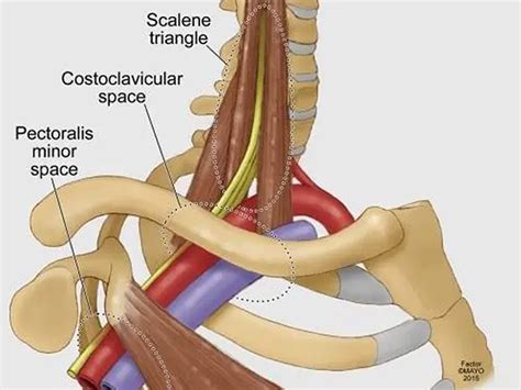 Aiello Family Chiropractic | Scalene Syndrome