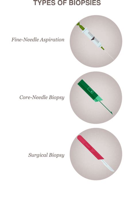 Breast Biopsy: Procedure Types, Results and Recovery - 24Medica