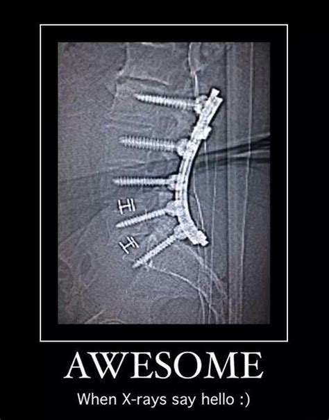 Funny Xray Quotes - ShortQuotes.cc