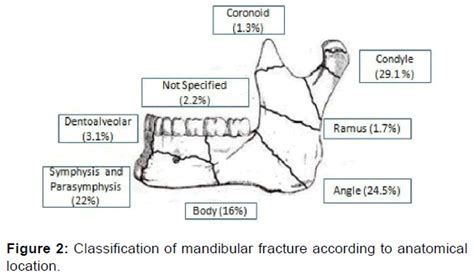 Mandibular Fracture Classification