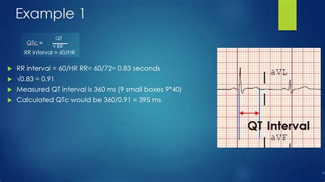 How to properly calculate a Qtc - YouTube