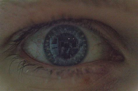 My friend unintentionally took a selfie in my eye : r/mildlyinteresting