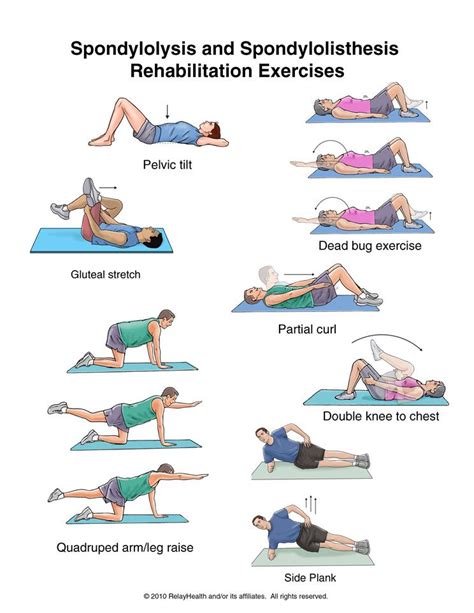 Physiotherapy Exercises For Spondylolisthesis – Online degrees