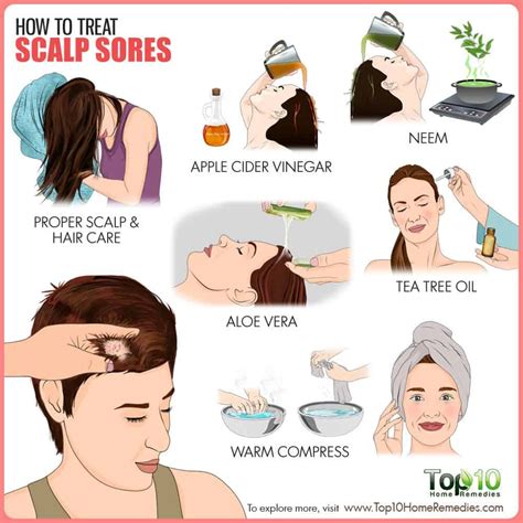 How to Treat Scalp Sores - eMediHealth | Dry scalp treatment, Sores on ...