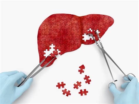 Liver Biopsy: Purpose, Procedure, and Risks