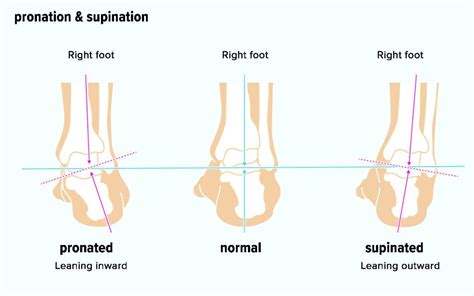 Supination and Pronation: What It Means for the Foot and Arm ...