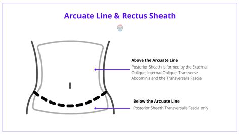 VRAM Flap - Indications, Anatomy, Technique (+ Images)