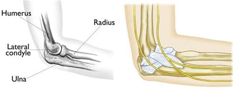 Elbow Fracture in Children | Boston Medical Center