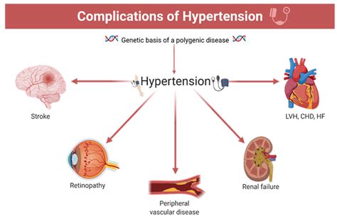 Pharmaceutics | Free Full-Text | Arterial Hypertension: Individual ...