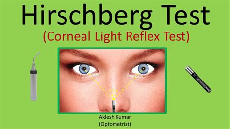 How To Check Corneal Reflex