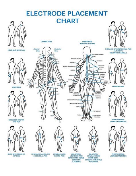 TENS electrode placement chart | Health and Wellness | Tens unit ...