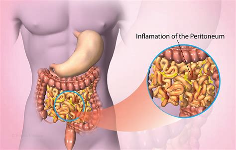 Health Condition : Symptoms, Causes, Treatment and More