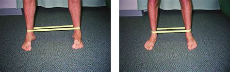 Foot Supination with Band Exercises Chicago | Check Out Our Exercises!