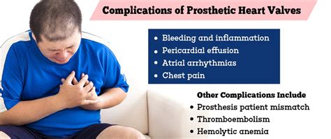 Prosthetic Heart Valves - Symptoms, Types, Advantanges, Disadvantages ...