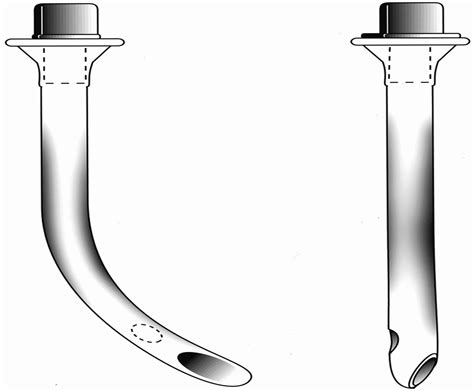 The Modified Nasal Trumpet Maneuver : Anesthesia & Analgesia