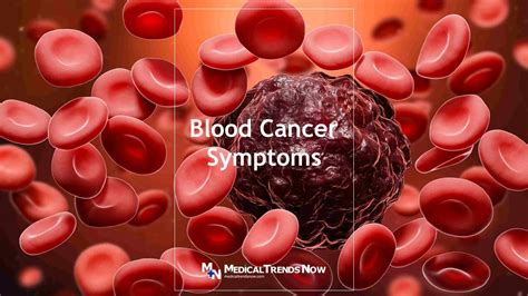 Blood Cancer Symptoms: 10 Warning Signs – Medical Trends Now