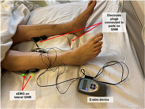 Frontiers | Safety and efficacy of electrical stimulation for lower ...