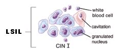 Abnormal Pap Test Results: Kimmel Cancer Center