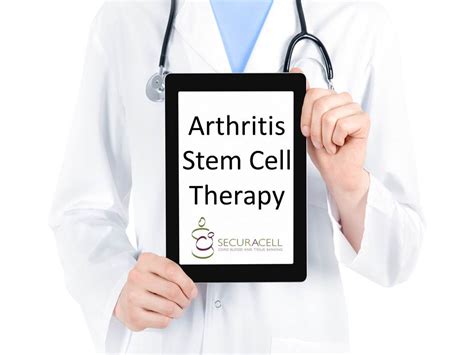 Stem Cell Treatment for Osteoporosis & Arthritis Shows Promise