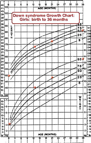 trisomy 21 growth chart Dua kali down syndrome anugerah tuhan: down ...