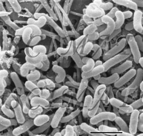 Lactobacillus rhamnosus. | Download Scientific Diagram