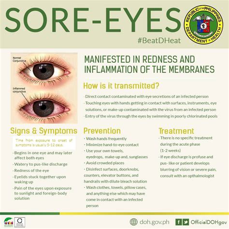 Sore eyes update: Para... - Tanay General Hospital EYE Center