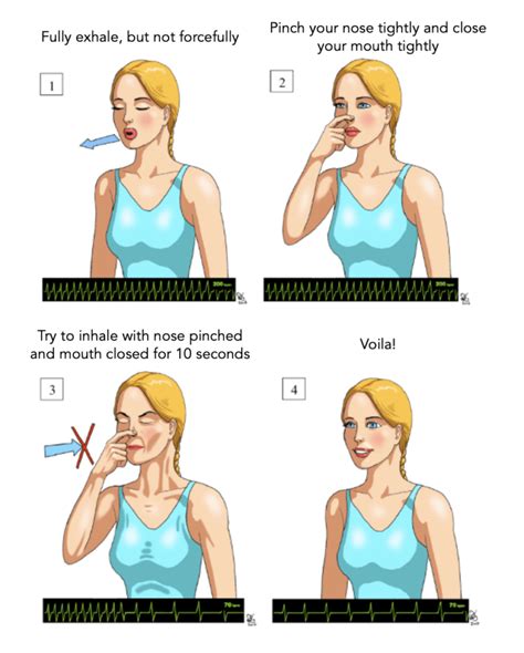 The Reverse Vagal Manoeuvre for SVT | Resus