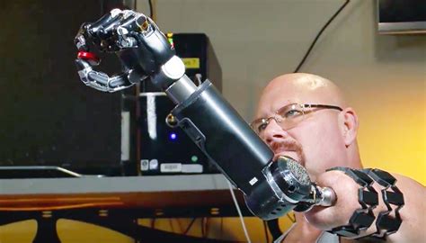 Man Maneuvers Robotic Arm With His Thoughts - Legacy MEDSearch