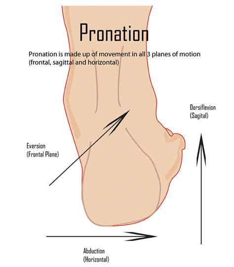 What Causes Pronation Of Foot