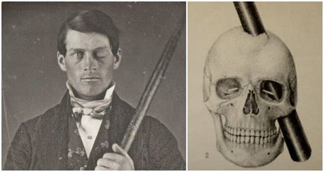 Phineas Gage, The Man Behind History's Most Famous Brain Injury