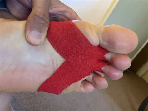 How To Tape Toes for Plantar Plate Tear - Plantar Health