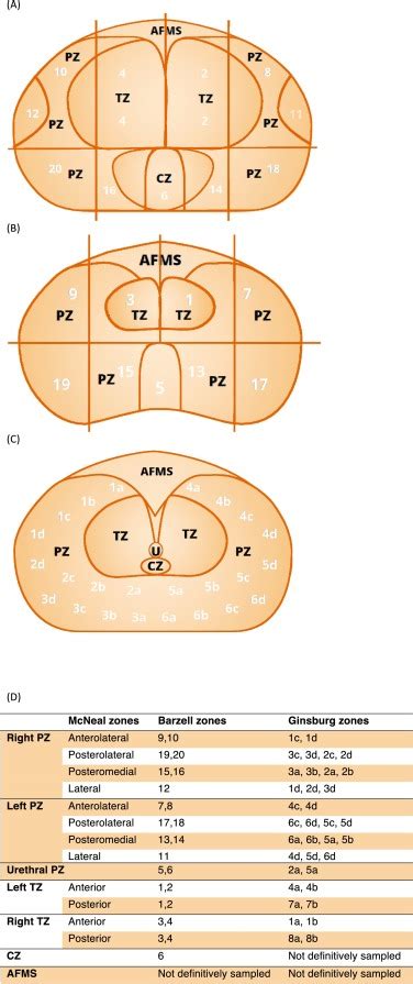 Mapping Contemporary Biopsy Zones to Traditional Prostatic Anatomy: The ...