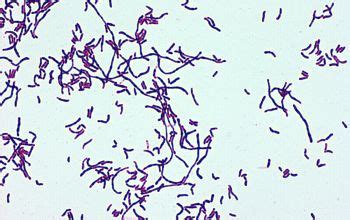 Corynebacterium Gram Stain