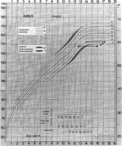 Growth chart showing growth delay and relative bone age and catch-up ...