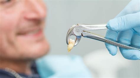 Advantages of Non-Surgical Tooth Extraction | 7DMC