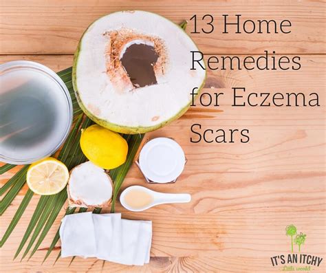 13 Home Remedies for Eczema Scars