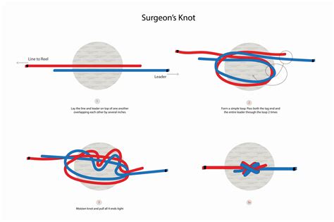 How to Tie a Surgeon's Knot: Quick Guide