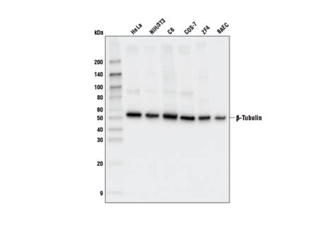 β-Tubulin Antibody | Cell Signaling Technology