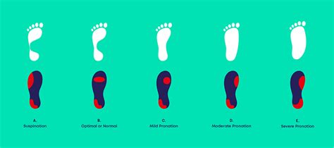 The difference between supination and pronation - Carl Todd Clinic