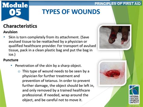 10-types-of-wounds3 – National Center for Sports Safety