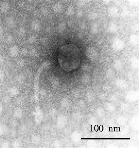 Transmission electron micrograph of phage 1-A4. | Download Scientific ...