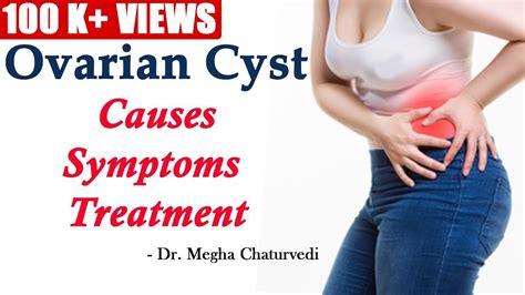 Ovarian Cyst- Causes, Symptoms and Treatment - YouTube